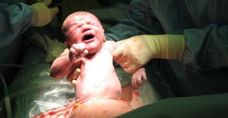 Repeat Caesareans 'often safer birth option'