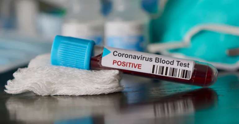 Ghana's Active Cases Now 785