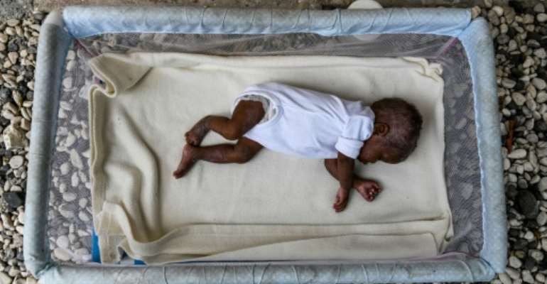 Even before COVID-19 there were an estimated 47 million children under five who were moderately or severely wasted. By CHANDAN KHANNA (AFP/File)