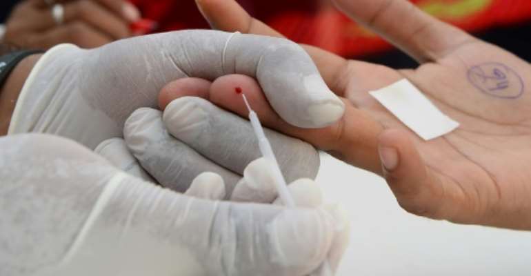 The UN says nearly 37 million people worldwide are infected with HIV which, if left untreated, can lead to AIDS. By Sajjad HUSSAIN (AFP)