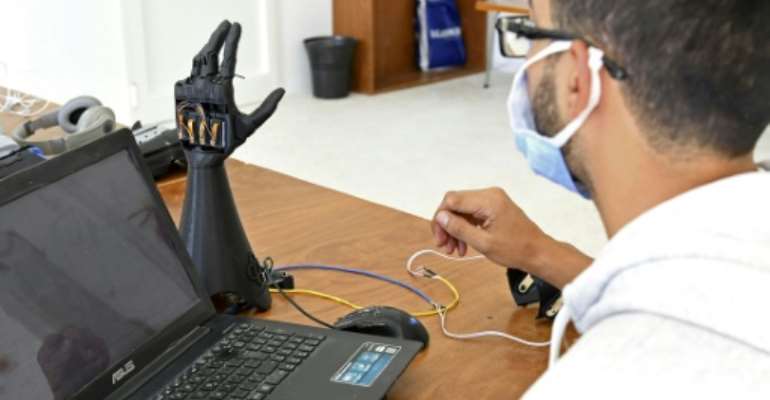 Tunisian startup Cure Bionics are developing a prototype of an artificial hand, which they hope will be more affordable to help amputees and other disabled people. By Bechir TAIEB (AFP)