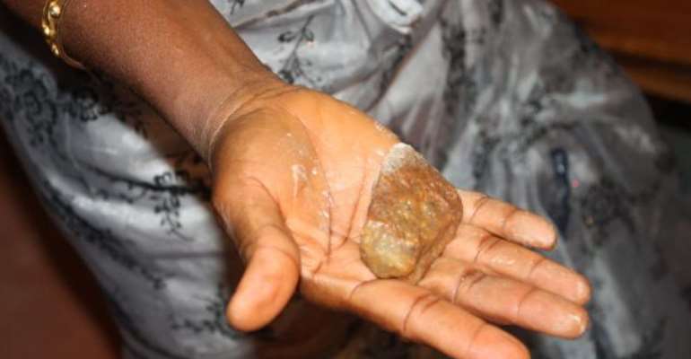WONDERS! A WOMAN DELIVERED A STONE.