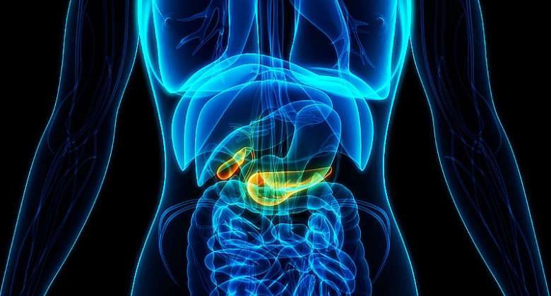 Pancreatic cancer: Causes, Symptoms & Treatment