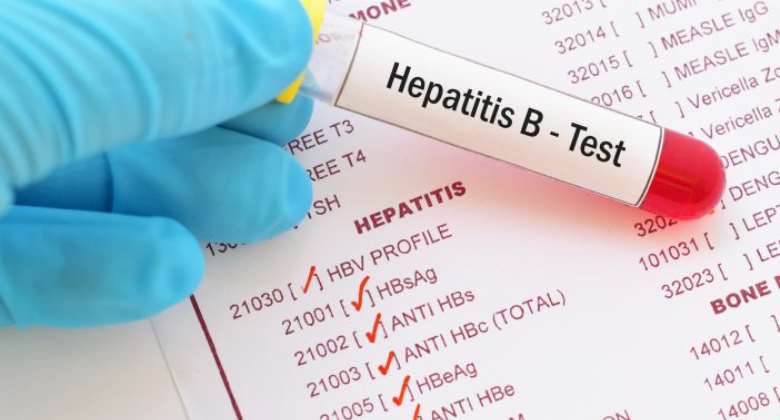 Impeding The High Prevalence Of Hepatitis B In Nigeria: The Pharmacists Perspective