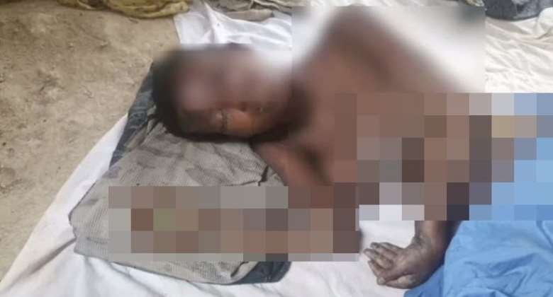 Mad man burns 25-year-old girl at Kotwi; victim cries for help