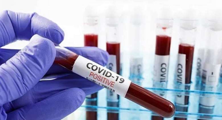 Ghana's active Covid-19 cases increase to 3,165
