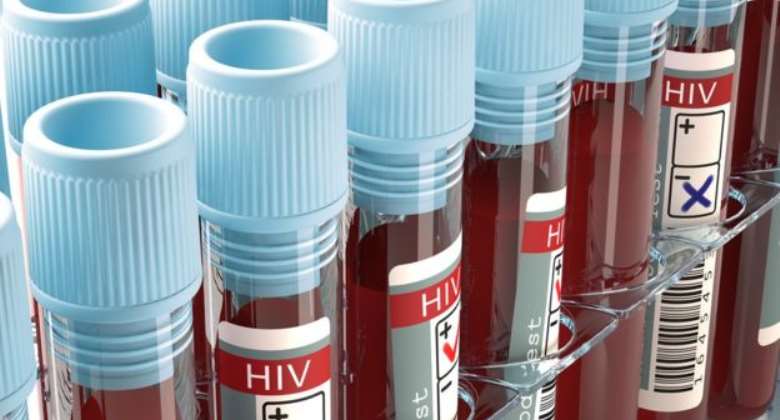 HIVAIDS has killed 40.1million of world population
