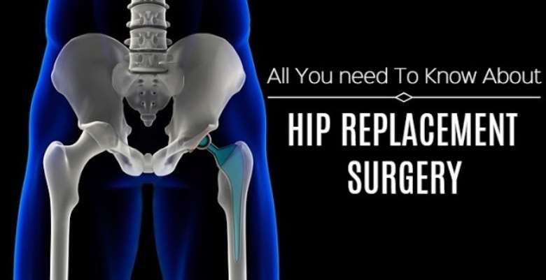 All You Need To Know About Total Hip Replacement.