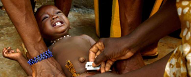 Female Genital Circumcision In Ghana? 2