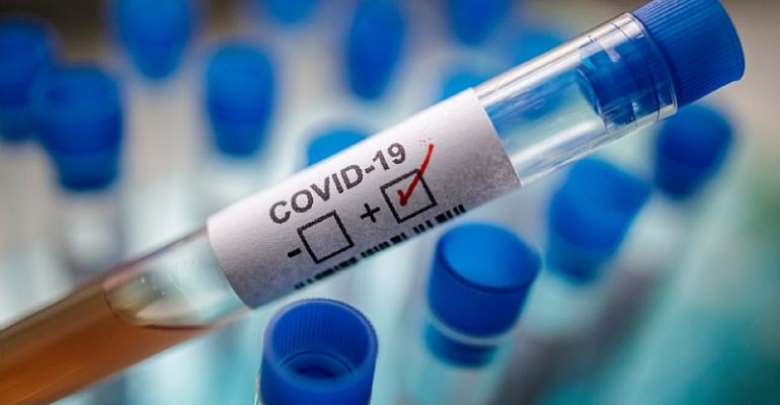 COVID – 19: Govt Alone Cant Fight The Pandemic – World Vision National Director