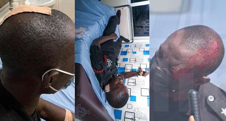 Arise Ghana Demo: Number of injured police officers increase to 15, two undergoing emergency surgery — Police