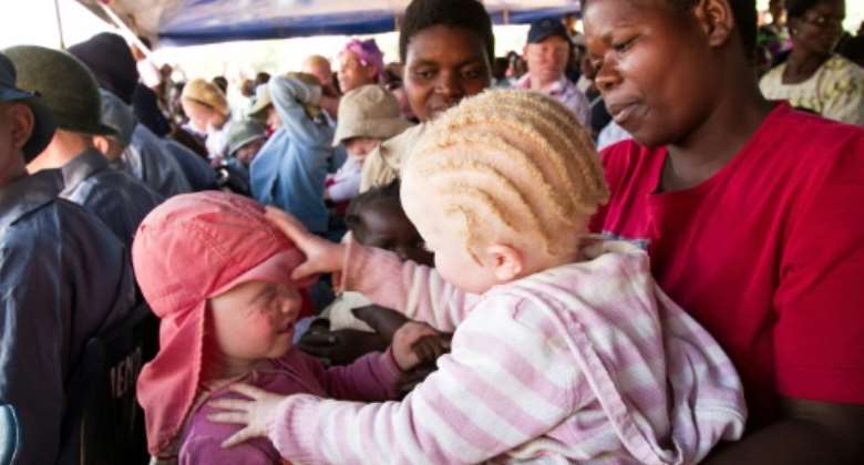 In some parts of Africa, people with albinism run the gauntlet of discrimination and even murder. Picture: children at an albinism awareness event in Malawi in 2015.  By ERICO WAGA AFPFile