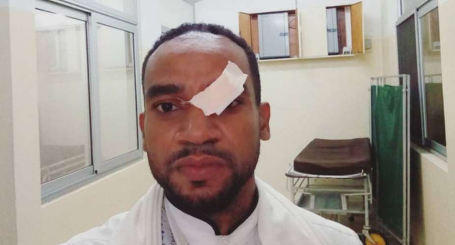 Actor, Pascal Amanfo Survives Accident, Nearly lost Eye