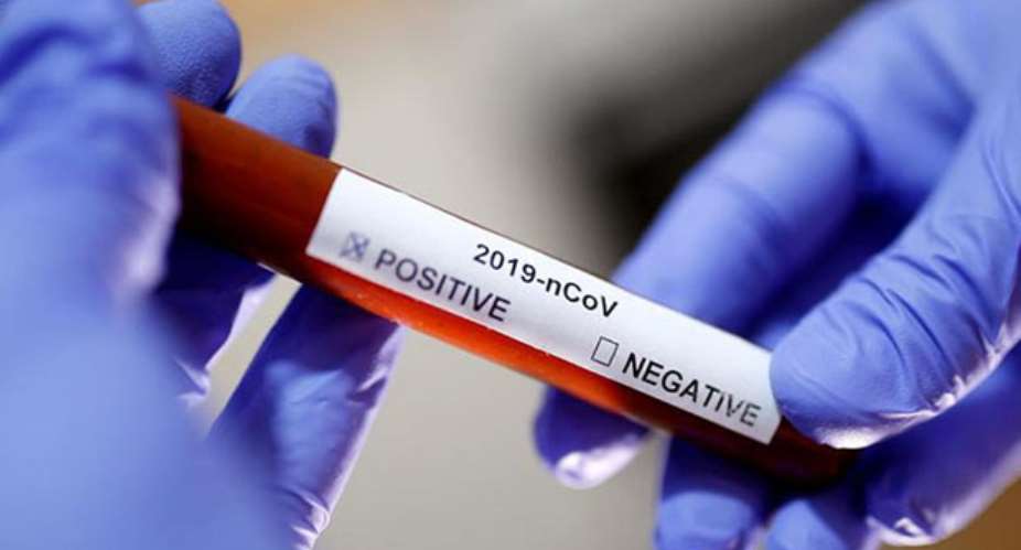 Coronavirus: 92 Test Positive At KIA – Akufo-Addo