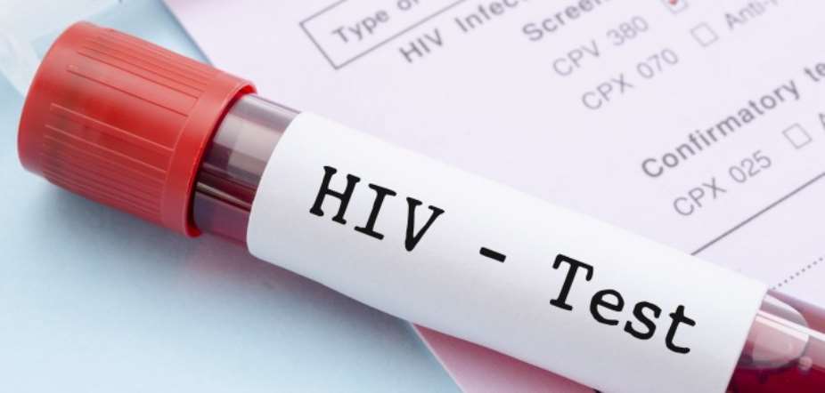 Ghana records 42 new HIV infections everyday — Ghana AIDS Commission