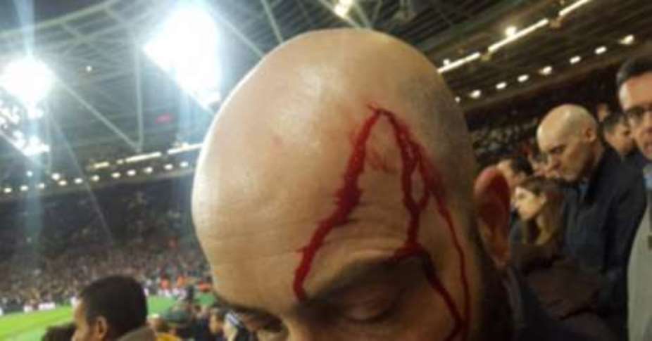 League Cup: West Ham and Chelsea fans involved in bloodied clash