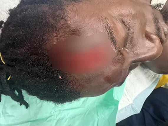 Andrews Opoku displaying his slashed forehead