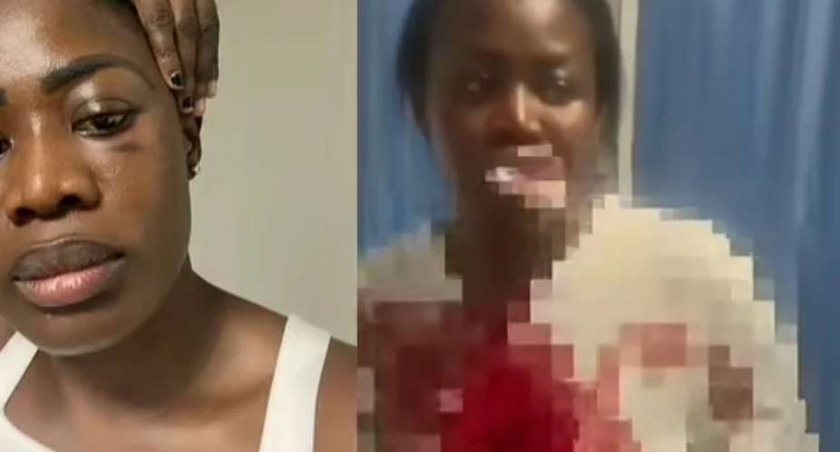 Nana Akua Addo hospitalised after alleged assault by husband