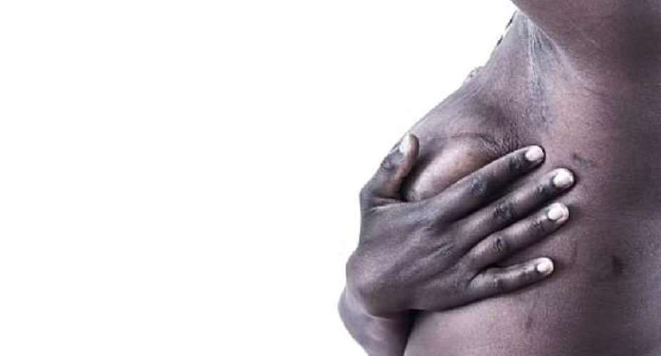 Seek breast cancer care within two weeks, not two years - Ghanaians told