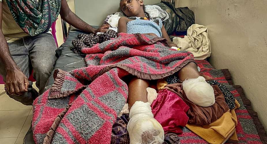 Iyerusalem, 10, needed both legs amputated after heavy shelling in Qarsole, Tigray, that also killed her brother. -  - / AFP