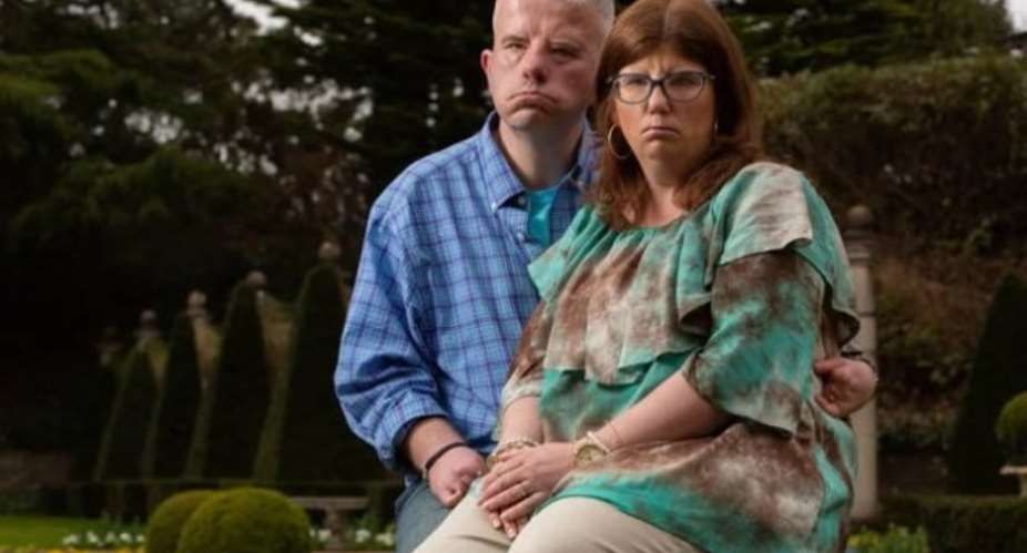 Couple who can't smile because of rare condition fall in love after meetingonline