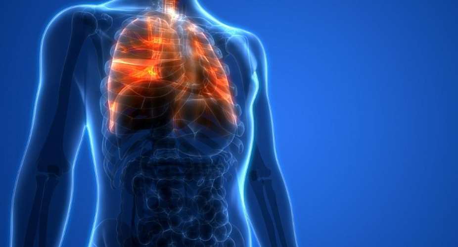 Lung Transplantation can help improve the quality of life for people suffering from end-stage lung disease