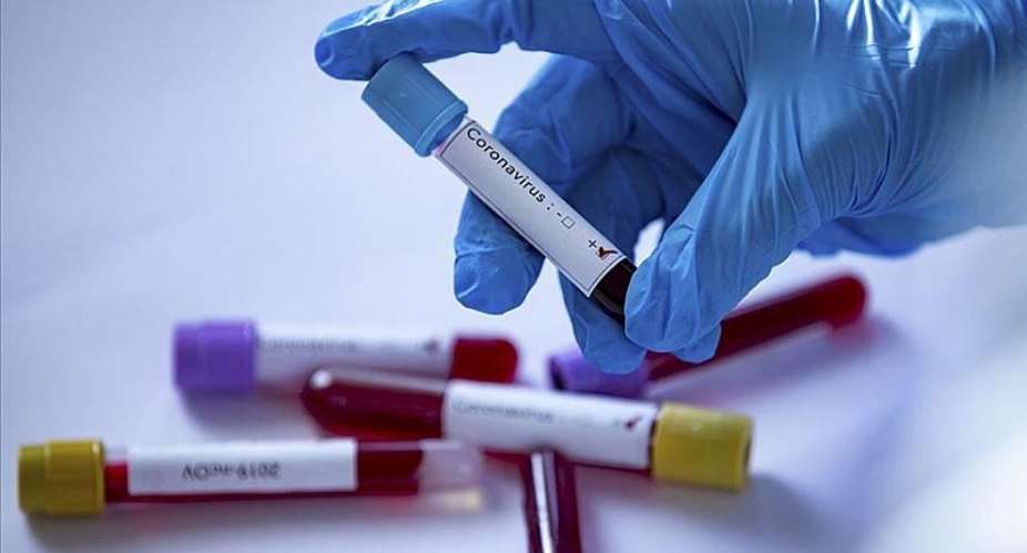 Covid-19 Resurrects, Ghanas Active Cases Rise Sharply Again To 877 From 620