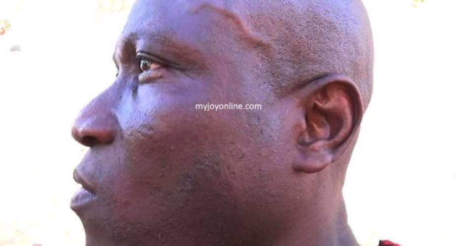 52-year old man beaten for making change gestures at Prez Mahama's convoy