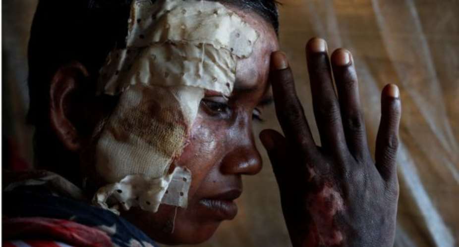 Report Estimates More Than 6,700 Rohingya Killed In Myanmar