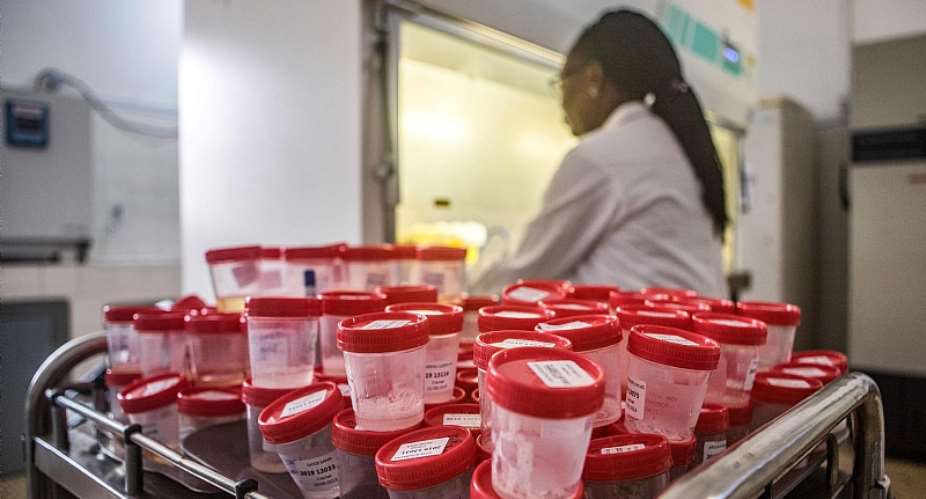 Scientist analysis flasks of saliva of TB patients.  - Source: Yanick Folly/AFP via Getty Images