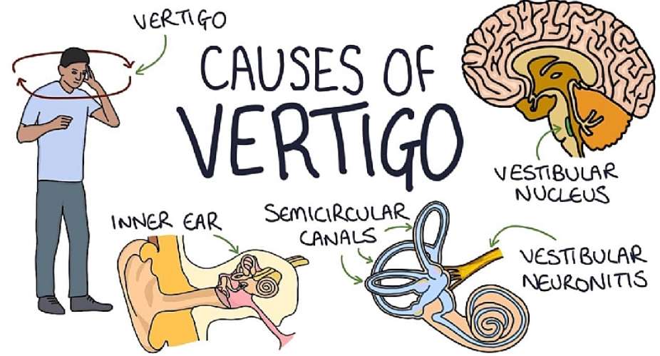 Are you suffering from Vertigo? These tips can be handy