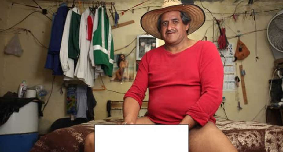 Man With The Worlds Largest Penis Cant Wear Uniforms To Work
