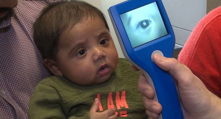 Babies Can Have Cataracts Too, Ensure Regular Eye Check-up From Birth Itself