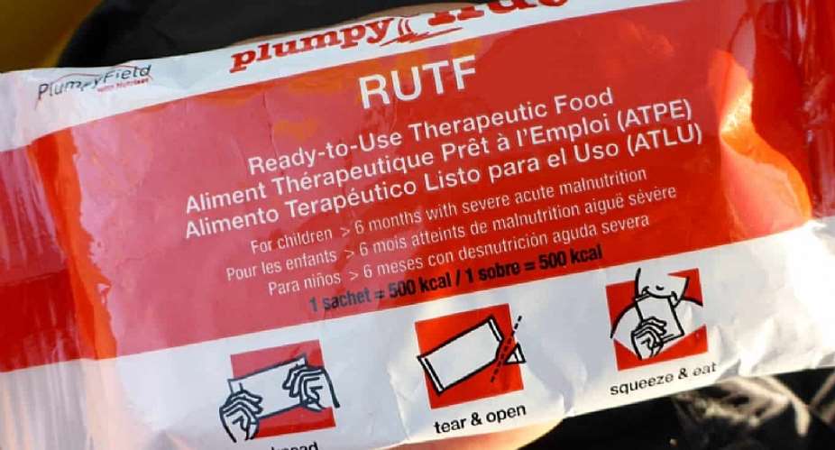Unavailability of plumpy-nut affecting treatment of kwashiorkor — Nutritionist laments
