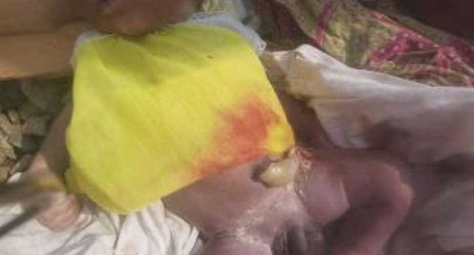 A day-old baby dumped at Dome-Crossing