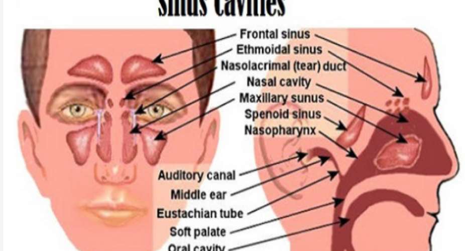 Sinus Infections Caused By Fungus