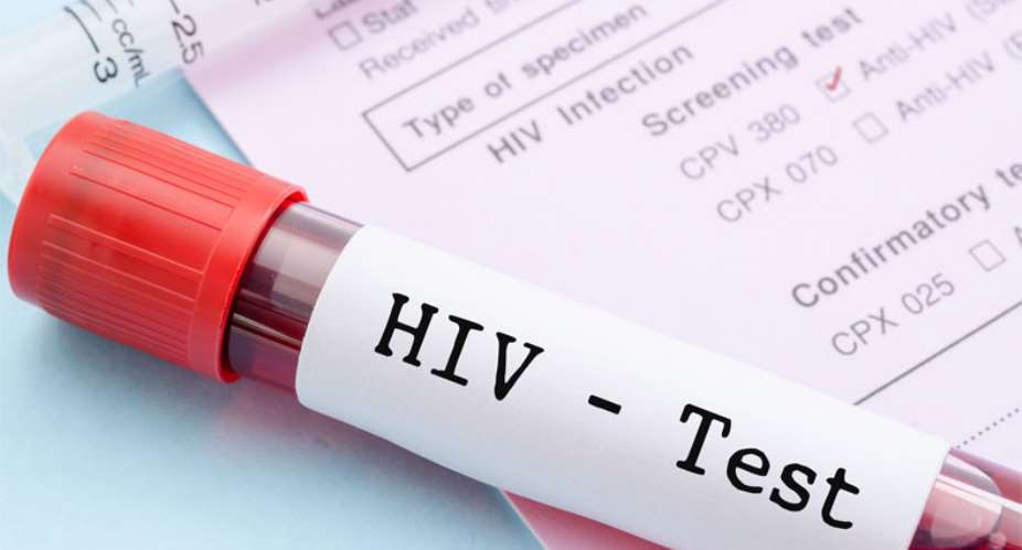 Tema: 1,072 Test HIV Positive