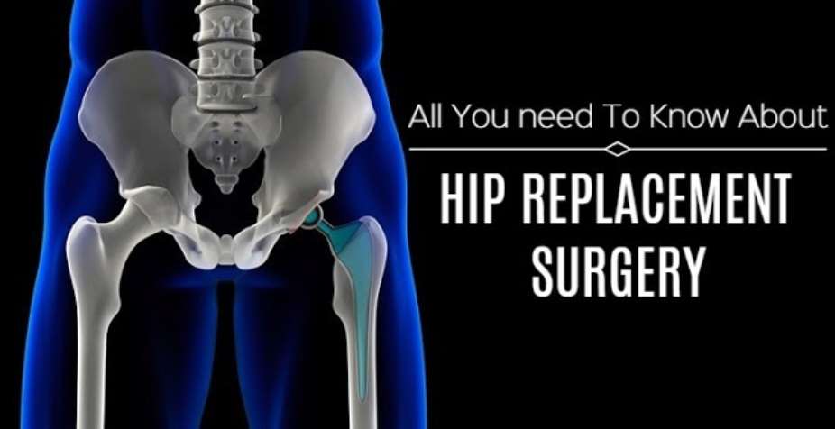 All You Need To Know About Total Hip Replacement.