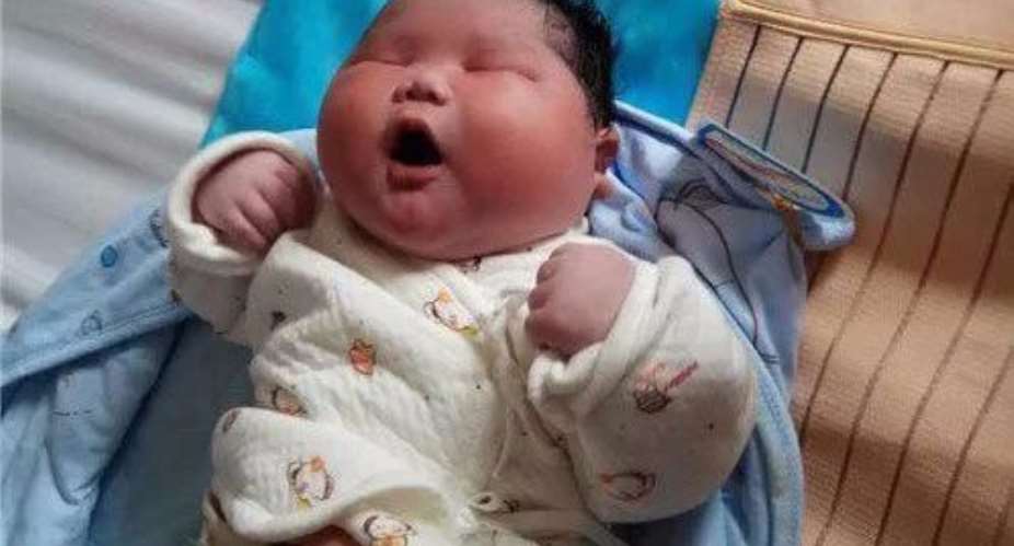 Giant baby weighs 15 pounds – double normal newborn weight