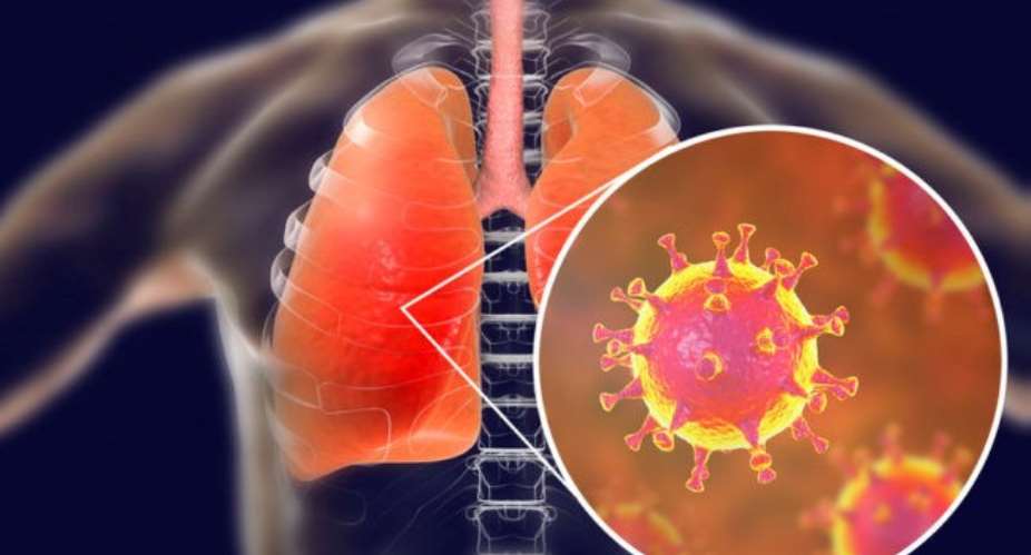 Coronavirus COVID-19 – Well, regarding those in China almost everyone smokes there, which weakens the lungs, the primary target of the Coronavirus.