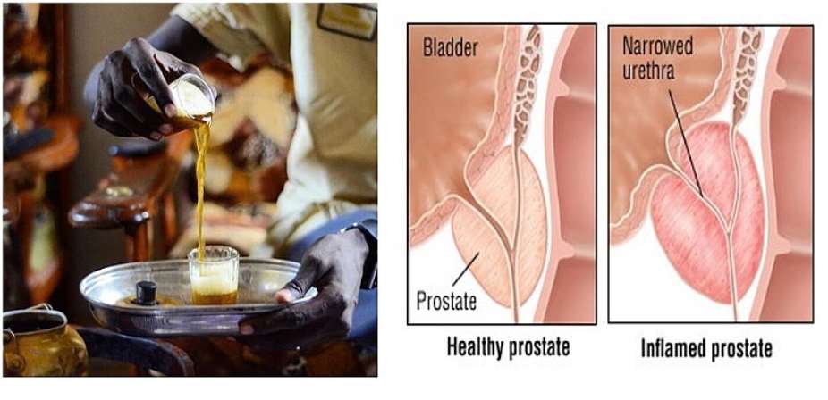 Attaya: Improves Prostate Health?