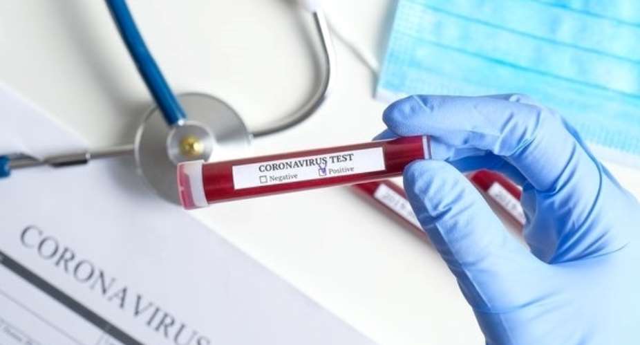 Coronavirus: We Need More Testing Materials – Noguchi Boss