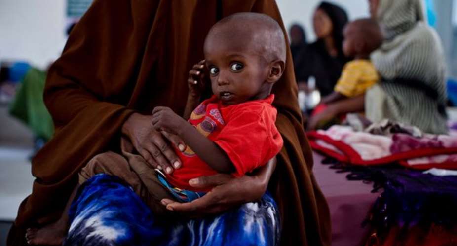 Eid Abdi Muhammed, 18 months old, in the stabilisation ward for severely malnourished children in Hargeisa, Somaliland. Photograph: Kate HoltUnicef
