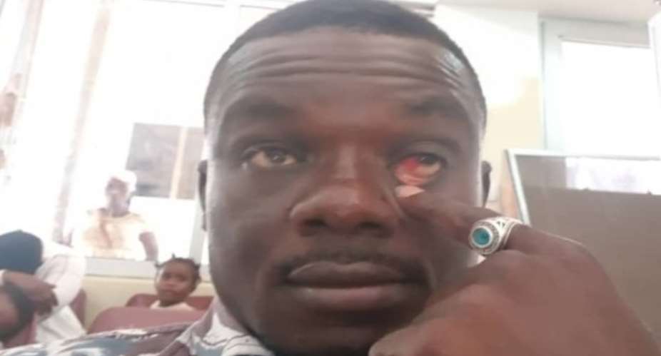 Assaulted Ghanaian Times Reporter Bemoan Police Assault On Citizens