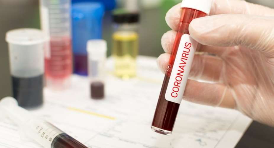 Liberia Confirms 2 Coronavirus Cases