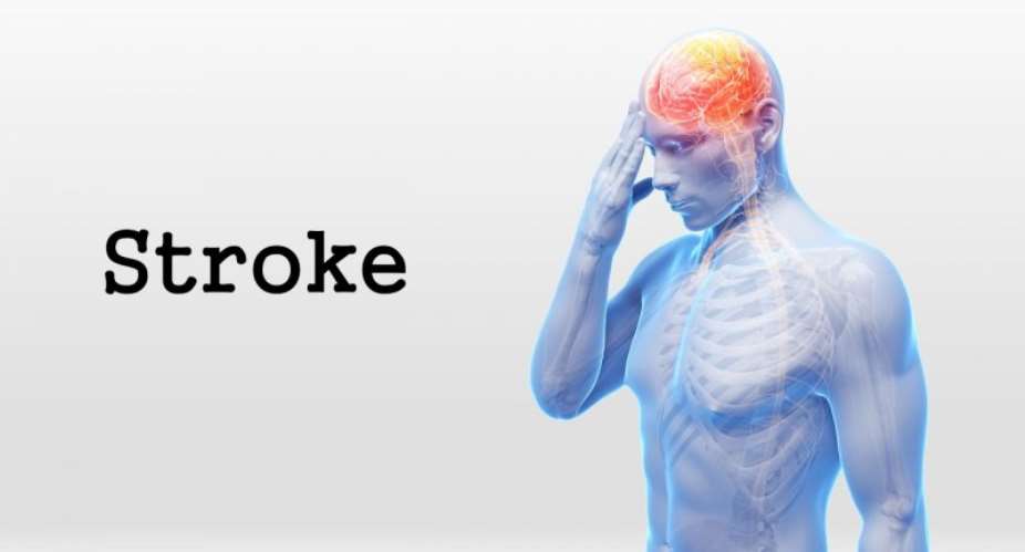 The Battle Against Stroke: Progress and Prevention