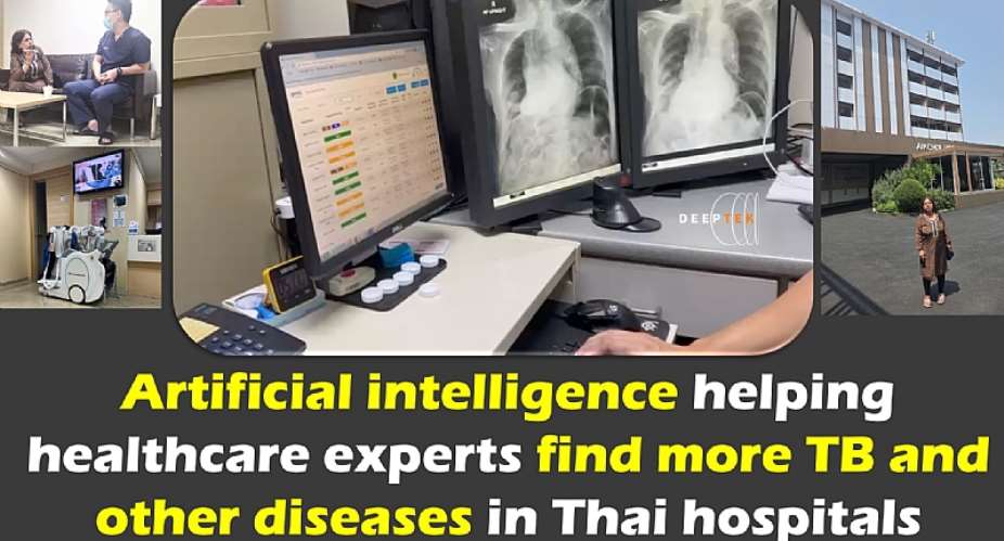 Artificial intelligence helping healthcare experts find more TB and other diseases in Thai hospitals