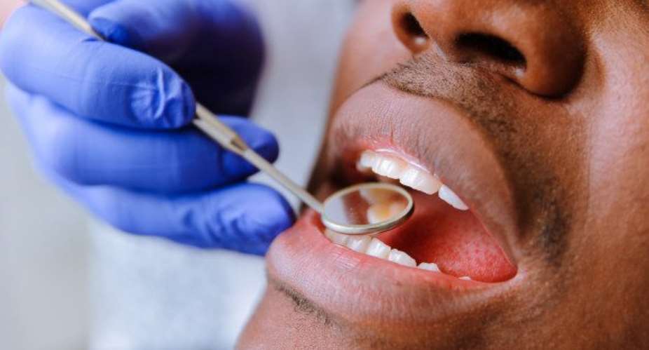 UWR: Lack of Dental X-Ray affecting oral health services in Tumu