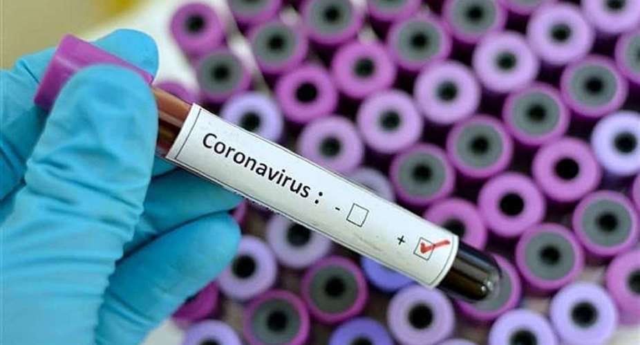 The Appeal Of A Ghanaian On The Global Coronavirus Pandemic