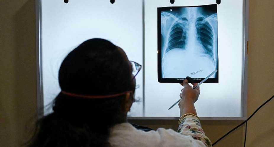 There have been substantial improvements in some areas of TB therapeutics.  - Source: Punit ParanjpeAFP via Getty Images